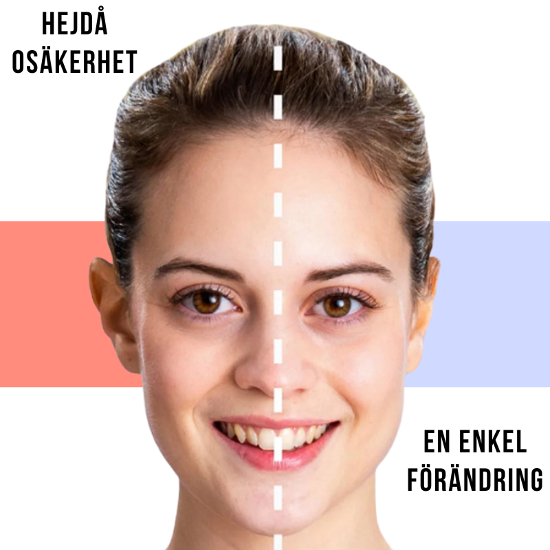 Shaply™ Ear Corrector